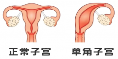 河北残角子宫试管妈妈必看：医院选择、费用清单与成功秘诀！