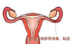 长沙输卵管粘连患者必看！试管方案、费用及注意事项一本通！