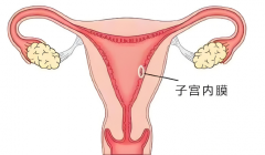 内分泌失调引发内膜过薄，高龄女性试管能否逆袭成功？